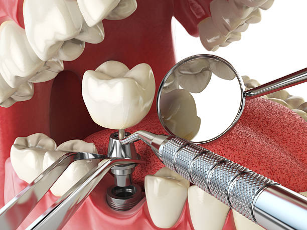Best Dentist for Tooth Abscess  in Lordstown, OH